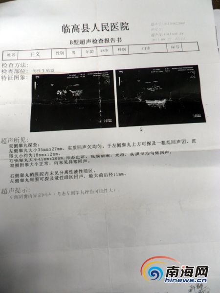 男子称审讯被打致睾丸坏死派出所否认打人