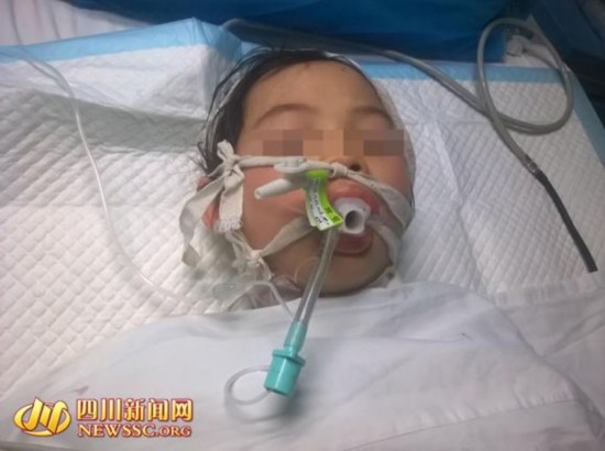 四川10岁女孩被养母砍成重伤 已脱离生命危险