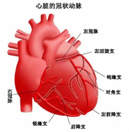 男子连续熬夜看球突发心梗 常德一医胸痛中心1小时内开通堵塞血管765.png 男子连续熬夜看球突发心梗 常德一医胸痛中心1小时内开通堵塞血管765.png