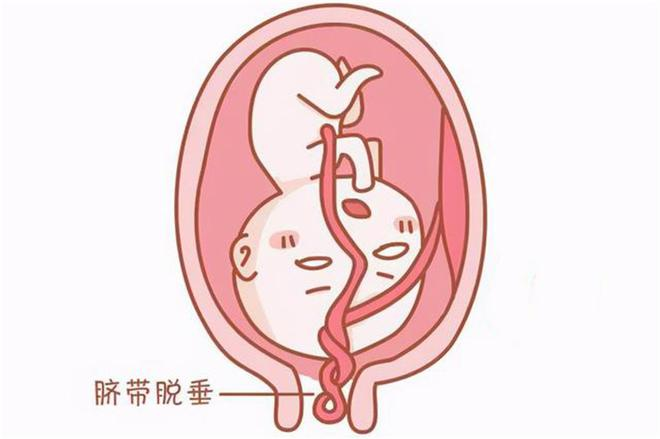 产妇脐带脱垂!常德一医医生忍住疼痛弯腰托举胎儿20分钟赢得生机557.png 产妇脐带脱垂!常德一医医生忍住疼痛弯腰托举胎儿20分钟赢得生机557.png