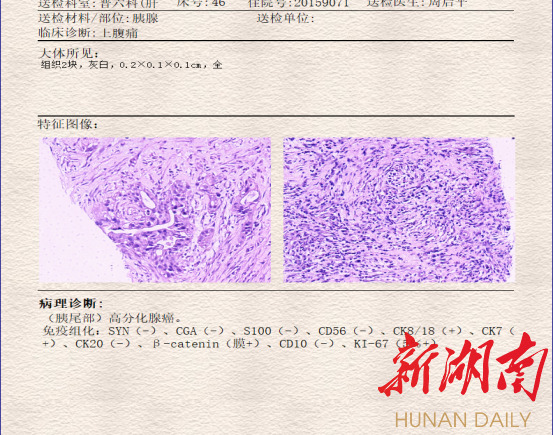 湘西州人民医院：成功为患者实施CT引导下穿刺活检术