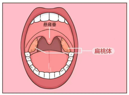 怎样防止新冠病毒的突袭？来听听扁桃体的发言吧！